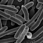 Thermotoga Neapolitana, il batterio che mangia i nostri rifiuti